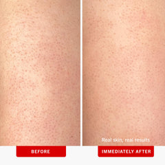 First Aid Beauty KP Bump Eraser pumice beads indicate physical exfoliation