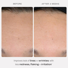 First Aid Beauty retinol complex serum pump demonstrates easy, controlled application for sensitive skin