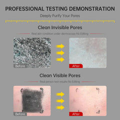 Flyleaf deep-pore-cleanser image highlights impurities and blackhead targeting for clearer skin