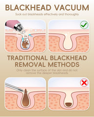 FLYMOO suction levels image highlights High, Mid, and Low options for customizable pore care.
