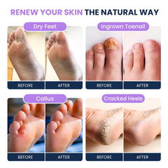 FOOT CURE foot massager spa demonstrates soothing massage for tired feet.