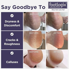 Footlogix double-sided foot file with coarse and fine grit for exfoliation