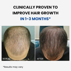 ForHair by Forchics application technique: easy steps for daily use.