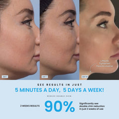 Forchics LiftLab jawline tightening feature in cosmetic massage session