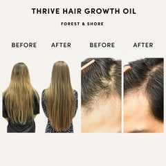 Forest & Shore Hair Growth Oil ingredients spread highlighting nine nutrients for scalp nourishment