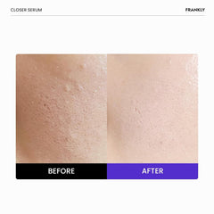 FRANKLY Closer Serum Jumbo texture swatch highlights smooth skin