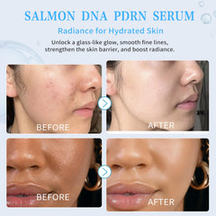 Fstudant Salmon DNA PDRN Serum ampoules packaging emphasizes freshness and hygiene