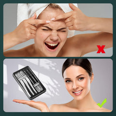 FVION six-piece acne extractor set ready for versatile blemish removal