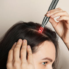 Glemme microneedle derma roller pen needle-detail close-up shows precision.