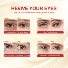 GONIM eye patches enriched with salmon DNA PDRN support skin resilience and hydration.