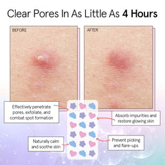 Grace & Stella patch infused with tea tree oil for soothing daytime blemishes.
