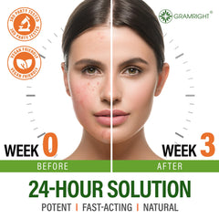 GRAMRIGHT Acne Face Cream salicylic exfoliation closeup suggests gentle pore refinement.