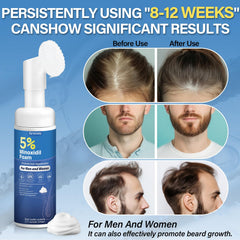 Greoay Minoxidil foam dispense showing precise application.