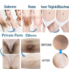 Gukei skin-lightening cream being applied for even coverage on body areas.