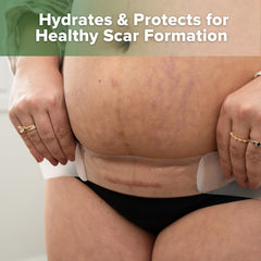 Haakaa C Section Scar Patches 1mm thickness provides gentle compression for early healing