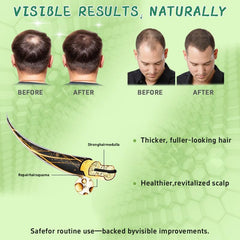 Hair Regrowth System peppermint oil detail suggests refreshing scalp feel