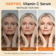 HANYWIL serum on cheek illustrates potential for smoother, brighter skin.