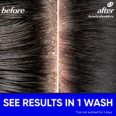Head & Shoulders rich lather close-up showing effective cleansing foam