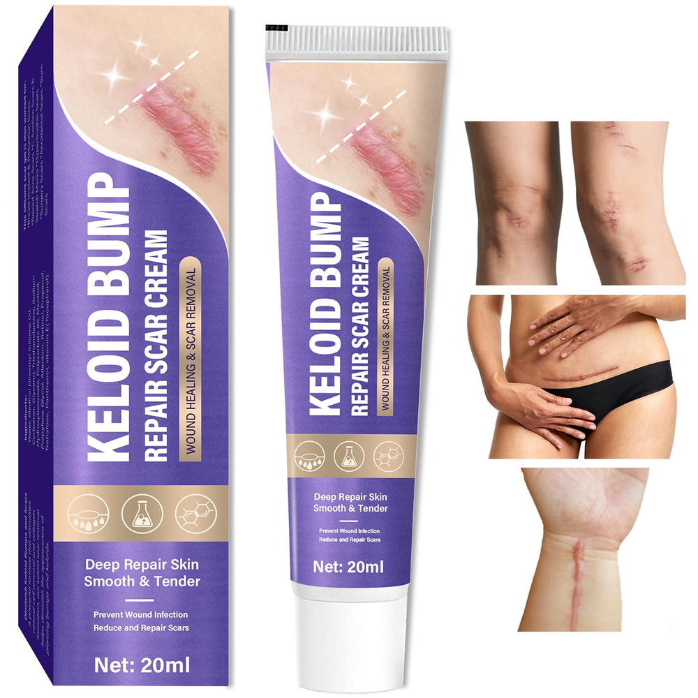 Hemir keloid bump removal cream packaging highlighting scar treatment benefits.