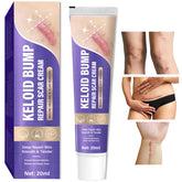 Hemir keloid bump removal cream packaging highlighting scar treatment benefits.