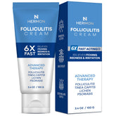 Hermon Folliculitis Treatment Cream tube on shelf showing targeted relief for irritated skin.