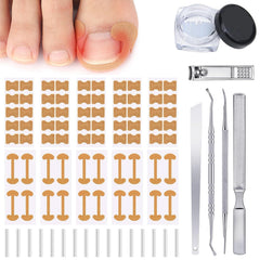 Hoiuter ingrown toenail corrector patch application demonstrates comfort-focused relief