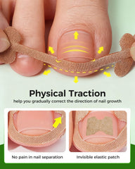 Hoiuter ingrown toenail corrector tools-pack highlights comprehensive home care