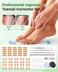 Hoiuter ingrown toenail corrector u-shape design shows secure fit during movement