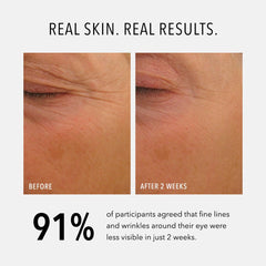 HydroPeptide Eye Authority peptide-boost targets fine lines around the eyes