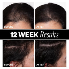 IGK Sponsored peptide-complex illustration emphasizes follicle support for healthier-looking hair
