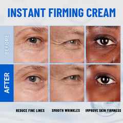 iMethod Perfection Eye Tightener puffiness image communicates refreshed under-eye appearance.