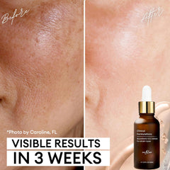 Inblair Rejuvenate Serum label close-up highlights clean ingredients.