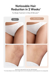 INIA HAUTE Pro Bikini Mode targets coarse hair for bikini area efficiency.