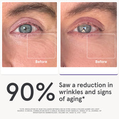 iRestore eye mask LED close-up highlighting dense LED array for eye-area care