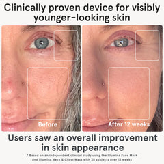 iRestore Triple-Wavelength Technology targets collagen boost and blemish care.