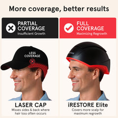 iRestore Elite maximum scalp coverage using VCSEL technology