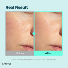 IsNtree Gim PDRN Hydro Bouncy Ampoule drop on hand demonstrates quick absorption.