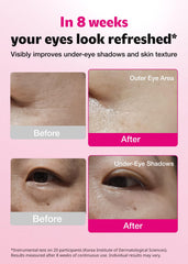 ISOI blemish care under-eye patch texture detail highlights gentle hydrogel feel.