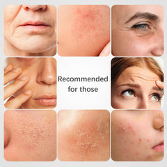 ISTON bio-collagen mask close-up highlighting elasticity and potential firming benefits.