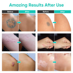ITECFREELY Tattoo Cover Up Makeup skin concealment for tattoos and marks with even finish