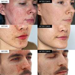 IVOSKIN Centella Asiatica extract visual highlights soothing repair action for irritated skin.