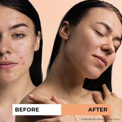 Jeune Naturelle Sea Buckthorn Oil ingredients card highlights vitamin-rich purity.