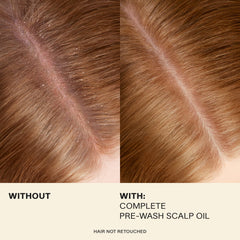 JVN Complete Pre-Wash Scalp Oil applied to scalp during massage supports healthier circulation