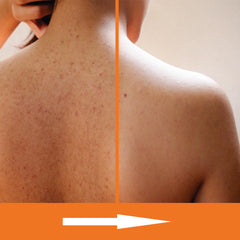 KERAPIL Salicylic Acid Body Wash application creates rich lather for cleansing and gentle exfoliation.