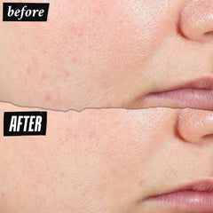 Kiehl's Expertly Clear texture-swatch demonstrates lightweight, non-drying hydration