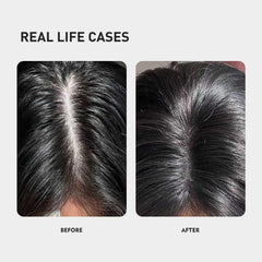 KINTOR KX-826 scalp-application showing targeted root treatment
