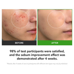 KIOSKIN Heartleaf extract soothing visual emphasizes anti-inflammatory calm for irritated skin.