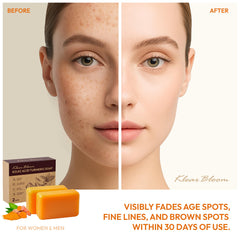 KlearBloom Kojic Turmeric Soap bar holder-display for daily skincare routine.