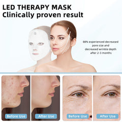KNNKNN face mask worn cordless for convenient hands-free treatment