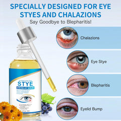 KODASNY Stye Eye Treatment closeup-application demonstrates gentle eyelid contact and easy use.